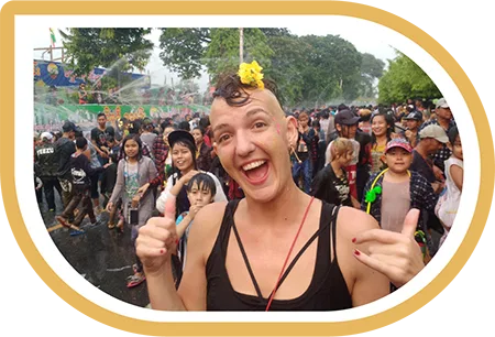 Lady-Alopecia-in-Myanmar