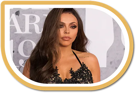 jesy nelson alopecia