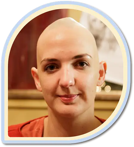 full bald lady alopecia