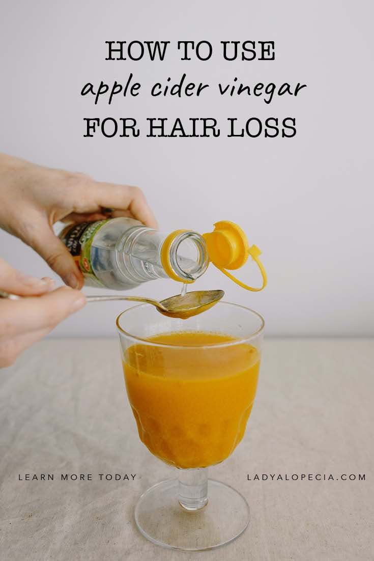 Apple Cider Vinegar for Hair Loss Does it Work? My 2020