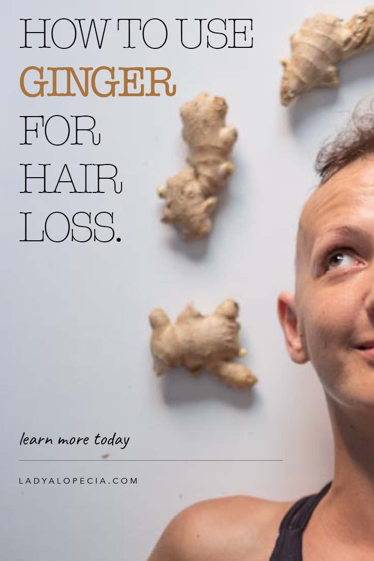 Ginger For Hair Growth DIY Masks & Best Supplements Lady Alopecia