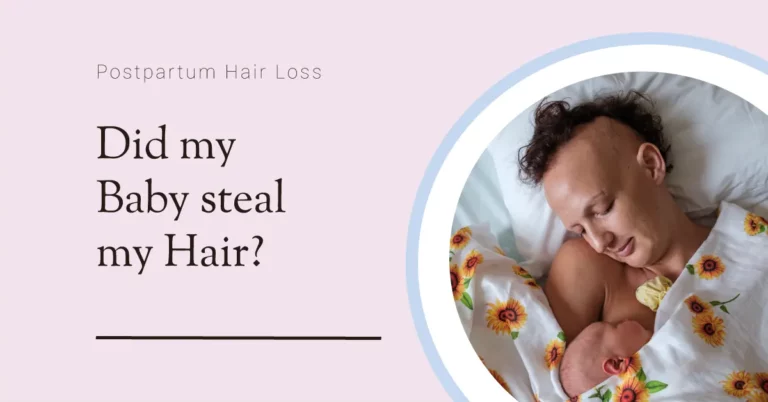 Alopecia lady with baby