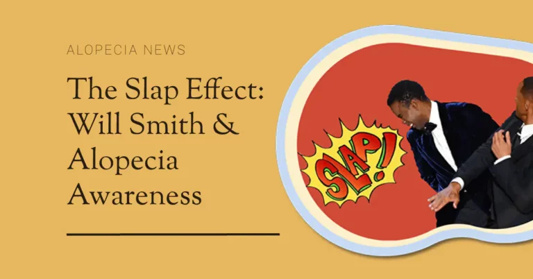 Will-Smith-Alopecia-Slap