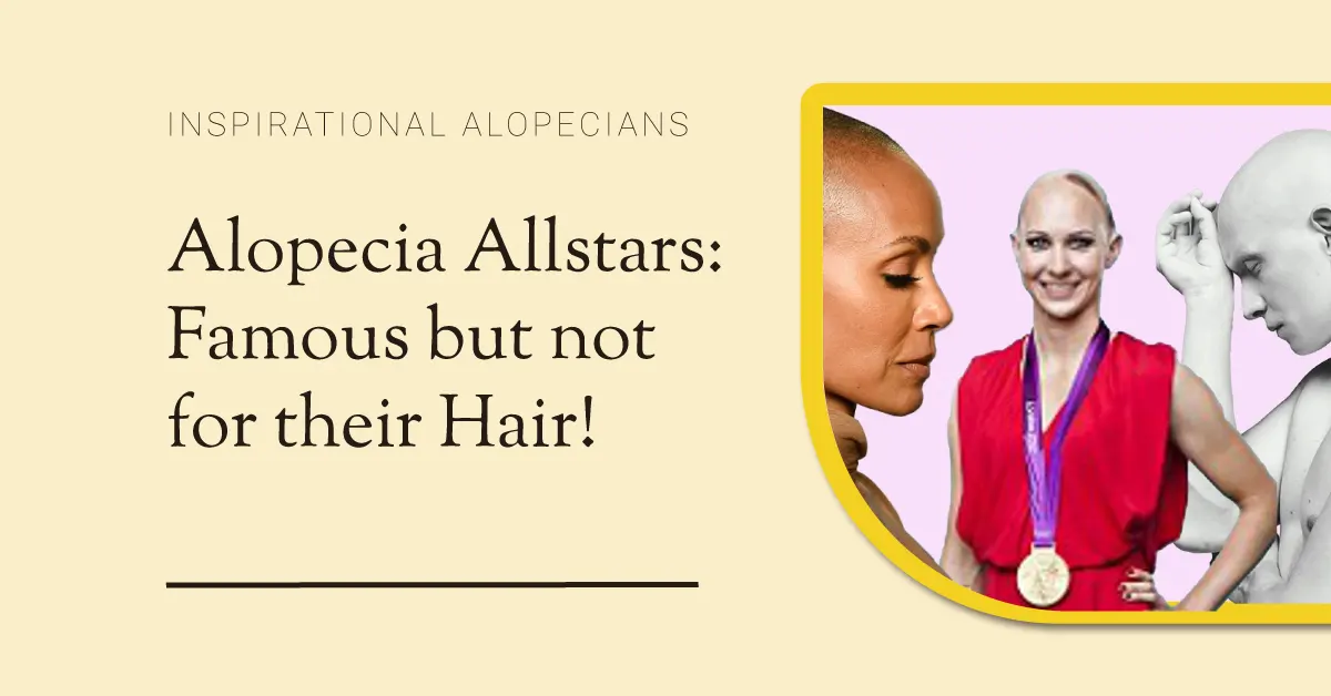 Famous Alopecians