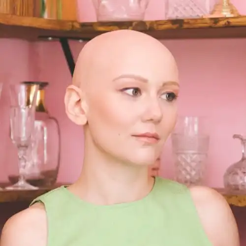 Molly Tuttle with alopecia