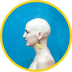 Lady Alopecia