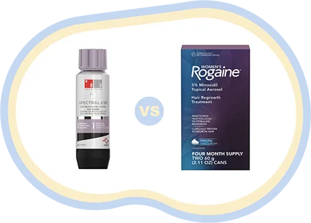 Nanoxidil or Minoxidil