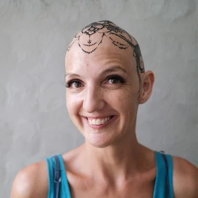 Emma, Lady Alopecia with henna head